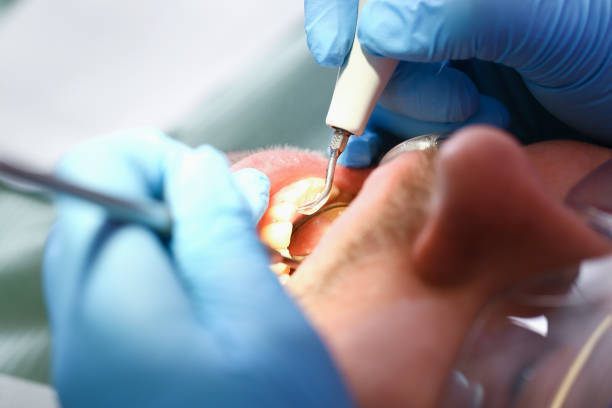 Best Orthodontic Emergency Dentist in Lake Magdalene, FL